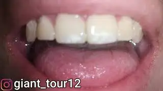 Playing with my uvula and tonsils