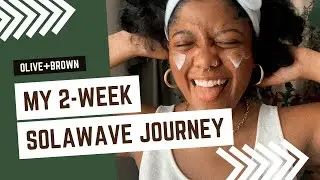 Hormonal Acne: My 2-Week SolaWave Journey