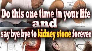 How to get rid of kidney stone