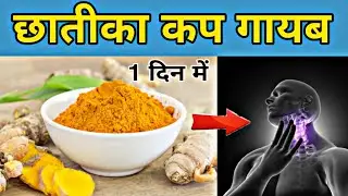 कफ निकालने के घरेलू उपाय | chati me jama kaf kaise nikale | jama hua kaf ko kaise nikale |