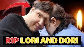 🚩RIP WOrld's Oldest Conjoined Twins Lori And Dori Have Sadly Died At 62 || Details Here👆