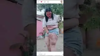 Oriental BBW arm amputee