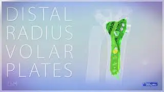 Distal Radius Volar Plates