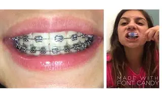 My Braces Brushing Routine! Hey girl Halle