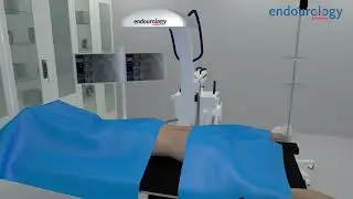 A short overview of how radiation can have an adverse effect on the human body.