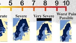 Pain scale meme - Sweden