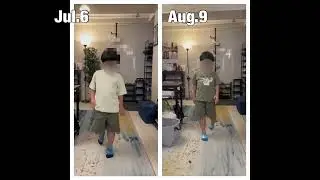 Duchenne muscular dystrophy treatment record after 4 month (9 years old )