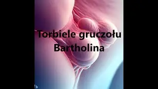 Torbiele gruczołu Bartholina