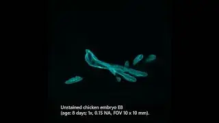 Z-Stack of chicken embryo - mesoSPIM lightsheet setup