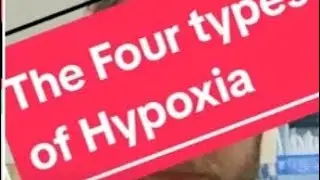The Four types of Hypoxia