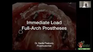 Immediate Load Full Arch Prostheses by Dr Gadia Peabody