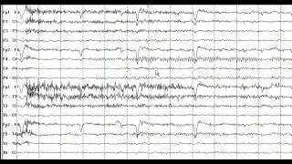 Mu Rhythm