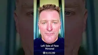 Facial Symmetry