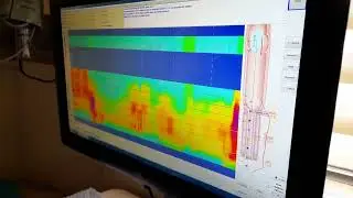 ManoScan - Biofeedback Session