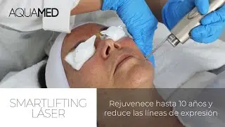 #RejuvenecimientoLáser | SmartLifting Láser - Rejuvenece de 5 a 10 años