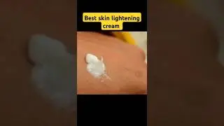 glyco 6 cream review| best skin lightening cream| #glyco6 #skinbrightening