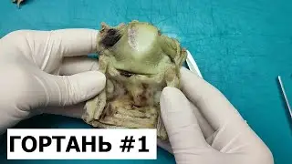 Гистологическое исследование гортани #1