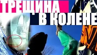 ПАДЕНИЕ БЕЗ ЭКИПИРОВКИ! КАК Я ПРОСРАЛ КОЛЕНО?