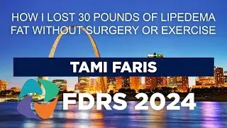 FDRS 2024 - How I Lost 30 pounds of Lipedema Fat without Surgery or Exercise