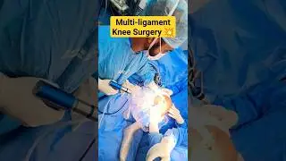 ACL+MCL Surgery🔥Multi-ligament Knee Surgery 