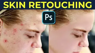 EASY Skin Softening In Photoshop - Skin Retouching Photoshop Tutorial