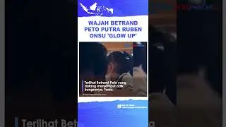 Wajah Betrand Peto 'Glow Up' Makin Bersih dan Tampan hingga Tuai Pujian