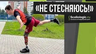 «Протеза не стесняюсь!»