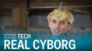 This real-life cyborg has an antenna implanted into his skull