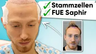 Wieder volle Haare mit Stammzellen & Haartransplantation | Athas Erfahrung