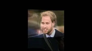 Príncipe William antes e depois 