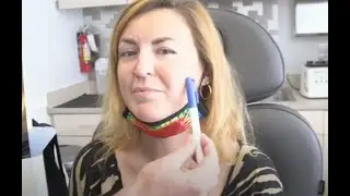 Buccal Fat Removal in Chicago | Face Sculpting By Dr Caughlin