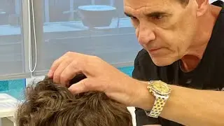 Hidden Shave FUE Demonstrated By Dr. Calder