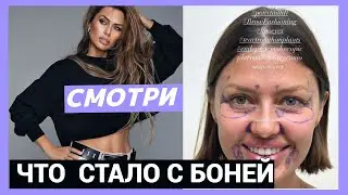 Что стало с Викторией Боней!