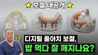 [1탄] 디지털 풀아치 보철! 자세히 알고가자👨‍🏫 ㅣ디지털 풀아치 보철의 재질? 무게? 강도? 궁금한 사람 여기 여기 모여라~!