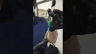 Плазмолифтинг