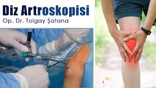 Diz Artroskopisi