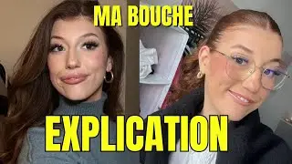 Mon histoire: Ma différence physique