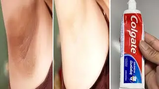 Stop shaving! Here's how to permanently get rid of facial and body hair.