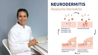 Neurodermitis - Ärztin erklärt worauf man achten sollte!