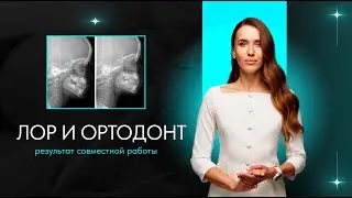 ЛОР-врач и врач-ортодонт: результат совместной работы