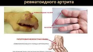 2 курс ФКП. Лекция на тему: 