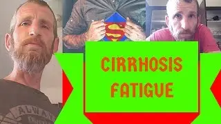 Fighting The Fatigue - A Losing Battle - Liver Cirrhosis Vlog
