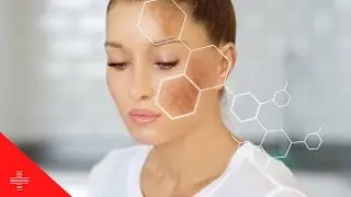 10 Surprising Causes of Age Spots and How to Prevent Them