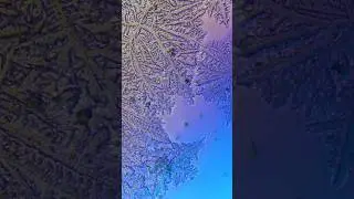 СЛЁЗЫ ПЕЧАЛИ И РАДОСТИ ПОД МИКРОСКОПОМ