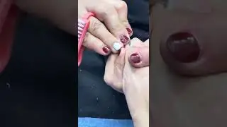 SO SATISFYING! SHE DID A GREAT JOB REMOVING THE DRY SKIN ON MY TOENAILS IT'S PAINLESS #shorts