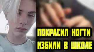 ПОКРАСИЛ НОГТИ И ИЗБИЛИ В ШКОЛЕ? Зачем парни, рэперы красят ногти ?