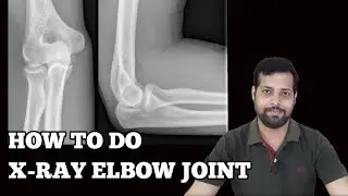 HOW TO DO X-RAY ELBOW JOINT. Step-by-Step Guide. 