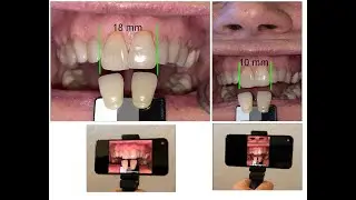 On Mobile Dental Photography: Why Make Your Photos Horizontally