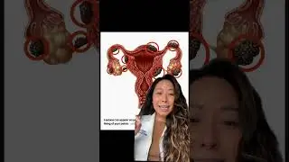 What is Endometriosis with Allara OBGYN, Dr. Pham