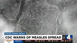 CDC warns of measles spread